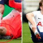 Cedera Harry Kane Buat Penggemar Tottenham Dan Timnas Inggris Cemas